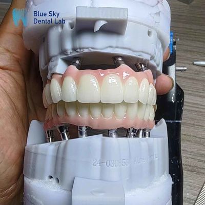 kaufen Implantate aus Zirkonia in Schichten online manufacture