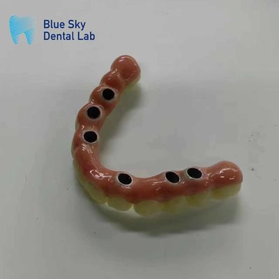 kaufen Sterilisation Dampfsterilisation Implantatkasten mit universeller Kompatibilität online manufacture