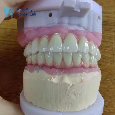 kaufen Universelle Kompatibilität Metall-Malo-Brücke mit reinem Titanrahmen online manufacture