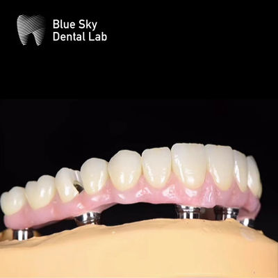 kaufen Blue Sky Nature Zahnimplantatgehäuse Mehrfachauswahl Implantatsystem online manufacture