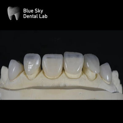 kaufen Ultra dünne schlanke Veneer-Fächer 0,3 mm dünnste kundenspezifische Veneer online manufacture