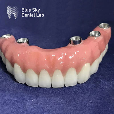 kaufen Universal autoklavierbare rechteckige Implantatgehäuse Glatte Oberfläche Silberfarbe online manufacture