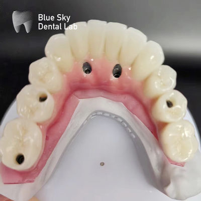 kaufen Vollbogen-Zahnimplantatgehäuse, die mit mehreren Implantatsystemen kompatibel sind online manufacture