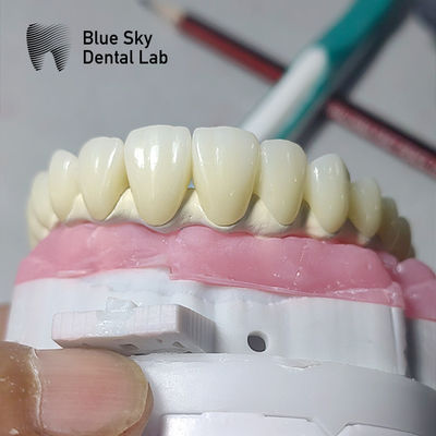 kaufen Universal-Zahnimplantatgehäuse mit mehreren Implantatsystemen kompatibel online manufacture