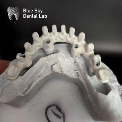 kaufen Reiner Titanrahmen Malo-Brücke anpassbares Implantat Blauer Himmel online manufacture