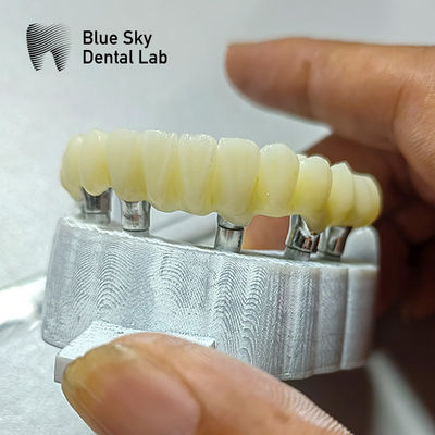 kaufen PMMA-Brückeimplantatgehäuse für Implantationsszenarien mit glatter Oberfläche online manufacture
