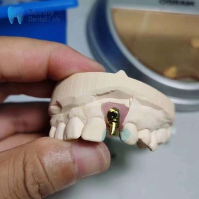 kaufen Regelmäßige Implantatgehäuse Anpassungsfähige Einzelsimplantat Zahn Offset Arch Implantatgehäuse online manufacture