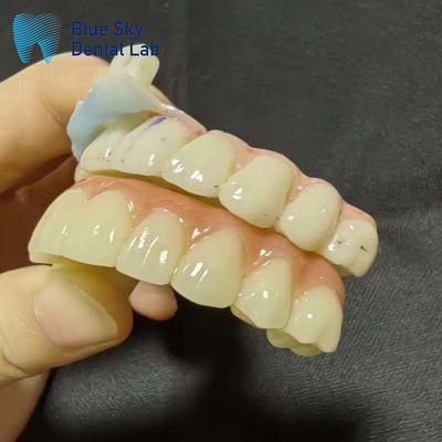 kaufen Implantationsfächer Künstliche Implantationsfächer für nahtlose Systemkompatibilität online manufacture