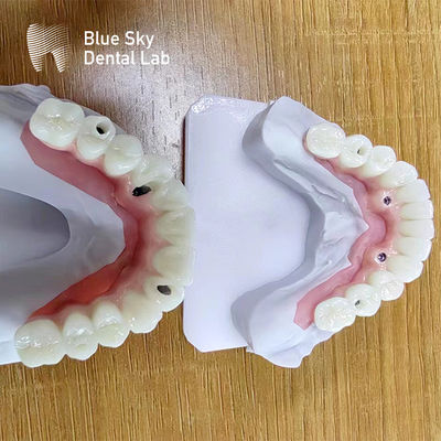 kaufen Dental Multi Implantat Gehäuse kundenspezifische Implantat Verfahren Gehäuse online manufacture