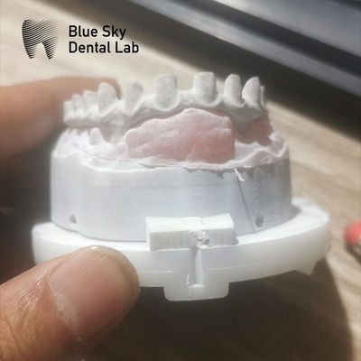 kaufen Anpassungsfähige industrielle Malo-Brücke in Silber und Gold Malo-Implantat-Brücke online manufacture