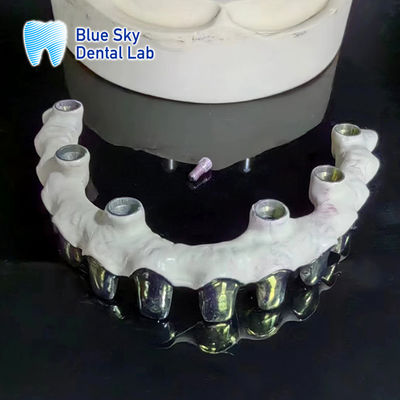 kaufen Reine Titanium-Malo-Brücke angepasste Silber-Metall-Rahmen-Zähne online manufacture