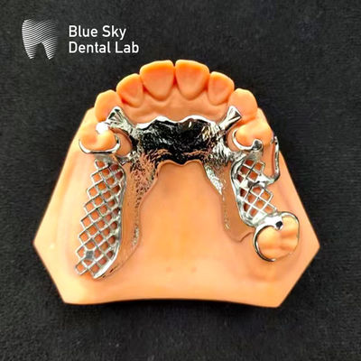 kaufen Skelettchrommetall-Teilprothese Druck CoCr-Prothesedesign online manufacture
