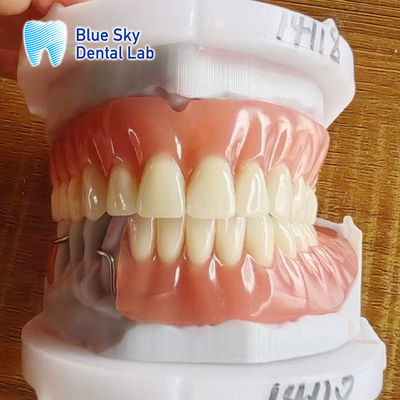 kaufen Resin-Akryl-Abnehmbare Teilprothese mit Klammern und Voll-Akryl-Prothese online manufacture