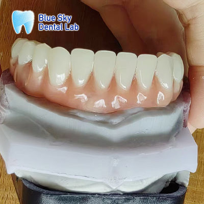 kaufen Komfortable volle Acryl-Zahnprothese natürliche Acryl-Harz-Zahnprothese online manufacture