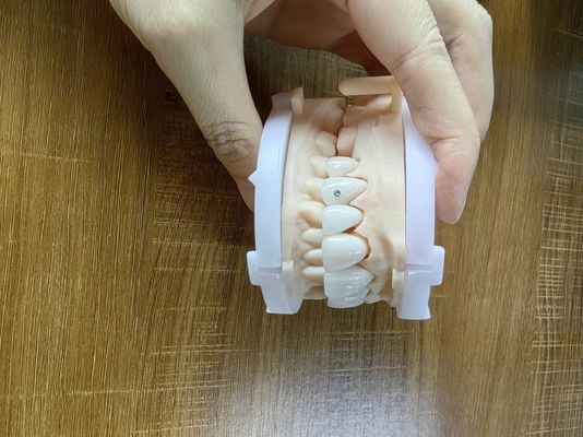 kaufen Hochdurchlässige Zirkonia Kronen Brücken Veneers mit individuellen Schmuck und Gold Schöne Zahnrestaurierung Fall online manufacture