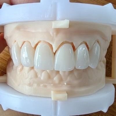 kaufen Natürliche Ästhetik Schicht Zirkonia Kronenbrücke für ein schönes Lächeln und eine gute Restaurierung FDA und CE Zertifizierung online manufacture