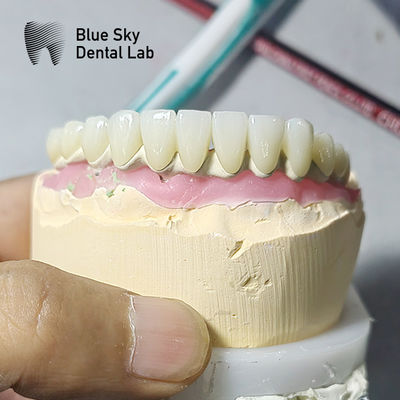 Personalisierte chirurgische glatte Dampfsterilisation Universelle Kompatibilität Implantatverfahren