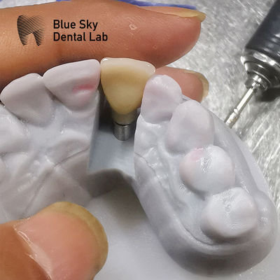 Biokompatibilitätsstudien Implantationsszenarien Dampfsterilisation