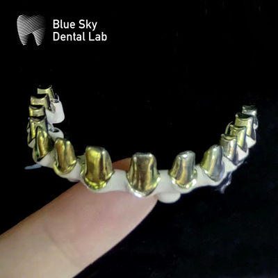 Silber-Gold-Universal-Rein-Titan-Metall-Rahmen