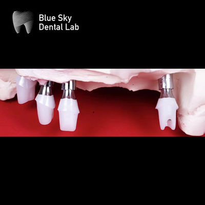 Blue Sky Zahnimplantate Zirkonia-Abbutment präzise geschliffen