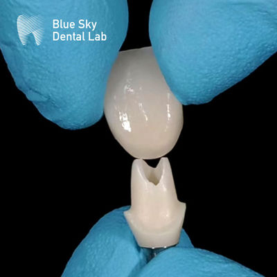 Oral Scan Custom Zirkonia Abutment Hochfestigkeit Zirkonia Abutments