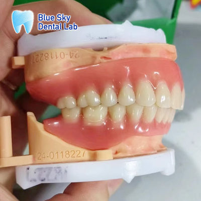 Vollbogenentfernbares Acryl-Prosthesis anpassbares natürlich aussehendes Zahnersatz