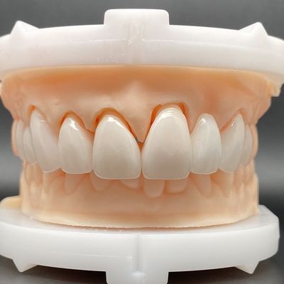EMax-Fineer-Gehäuse Passiv-Fitting in mehreren Farben machen ein schönes Lächeln