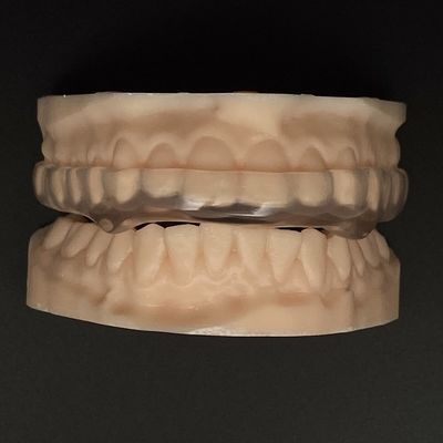 Klares Hart Weiches Orthodontische Nachtwache Atmungsschutz Schwerlastschutz Occlusal Splint Hart/Weich